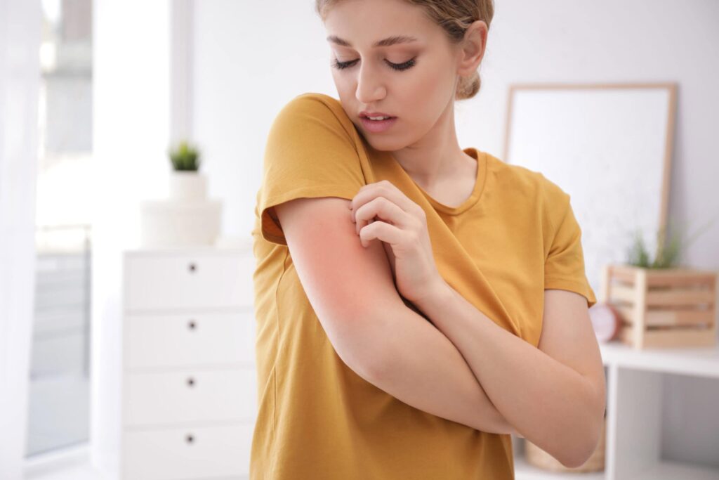 A person in a yellow shirt scratches a red, irritated area on their upper arm in a bright room.