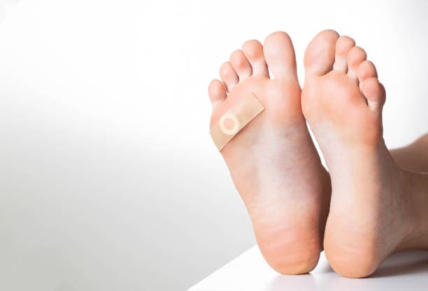 Two bare feet are shown soles up with a small adhesive bandage on the left foot's sole.